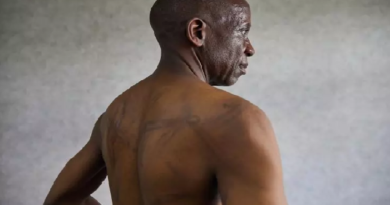 Tabassages et intimidations au Zimbabwe, où le président veut prolonger son mandat